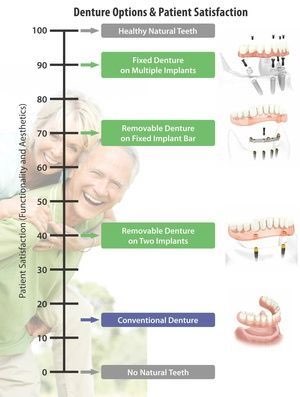 denture options and patient satisfaction